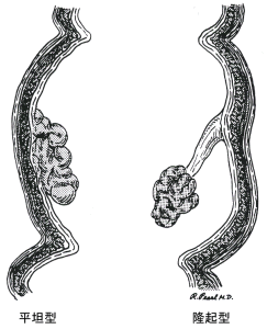 �咰�|���[�v