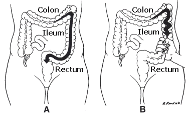 �ߕq�����ǌ�Q