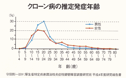 �N���[���a�̐��蔭�˔N��