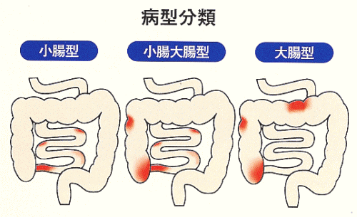 �N���[���a�@�a�^����