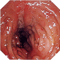 �N���[���a�摜