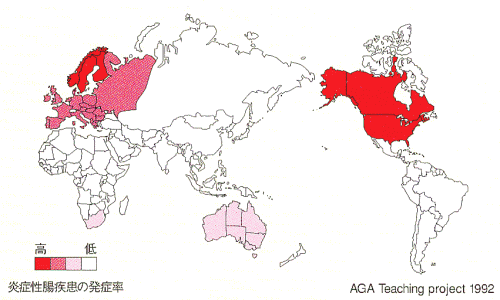炎症性腸疾患の分布