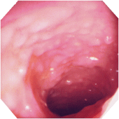 ��ᇐ��咰���@�摜