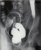 ��ᇐ��咰���@X���摜