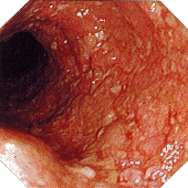 ��ᇐ��咰���@�����x