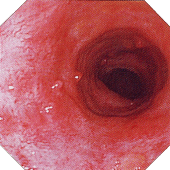 ��ᇐ��咰���@�ɉ���